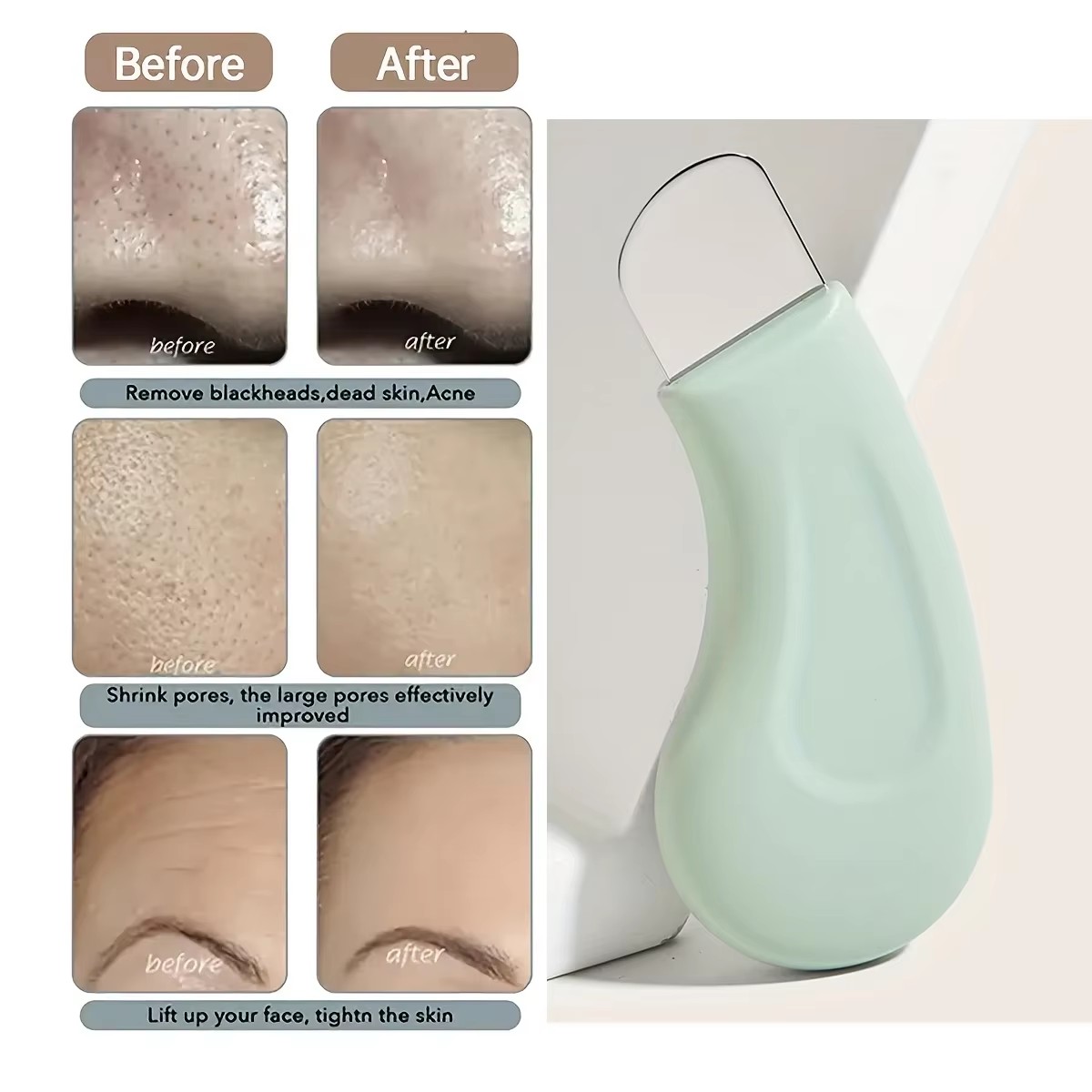 Nasal Aspirator - 1Pcs Blackhead and Whitehead Removal Tool