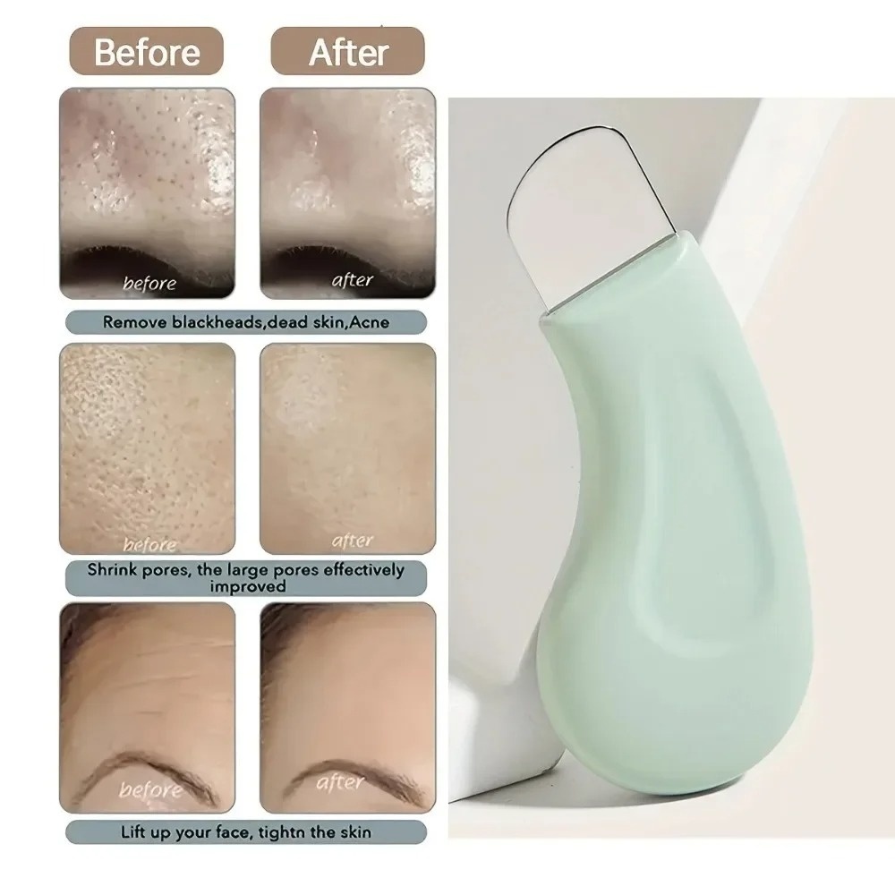 Deep Cleansing Blackhead White - Nasal Aspirator 리뷰 및 가격